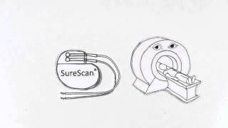 Medtronic SureScan Technology [upl. by Michey]