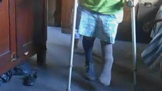 Shortleg crippled girl crutching in her house [upl. by Cob]