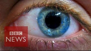 Stem cell cure for blindness tested  BBC News [upl. by Koziel310]