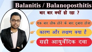 Best treatment of Balanitis  पुरुष के अंग में इन्फेक्शन और जलन का इलाज  Balanitis  Dr Nitish [upl. by Kaliope256]