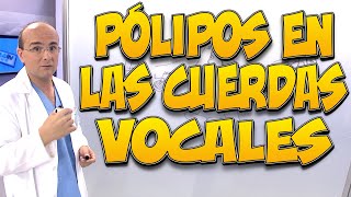 PÓLIPOS EN LAS CUERDAS VOCALES [upl. by Haneekas]