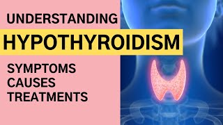 Understanding Hypothyroidism  Hypothyroidism Causes Symptoms Diagnosis and Treatment [upl. by Dyan]