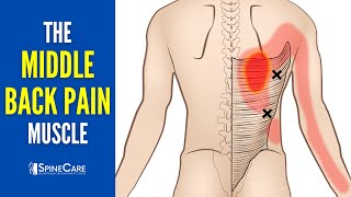 The 3 Middle Back Pain Muscles How to Target Them for INSTANT RELIEF [upl. by Jerry]