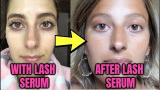 WHAT HAPPENS AFTER LASH SERUM IM HERE TO TELL YOU Before amp After Results [upl. by Erusaert]