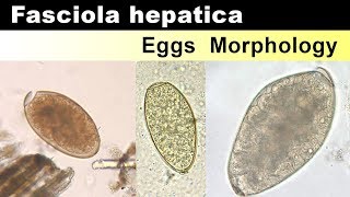 Fasciola Hepatica Eggs Morphology [upl. by Drandell901]