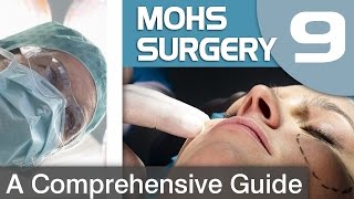 What is Mohs surgery [upl. by Frohman152]