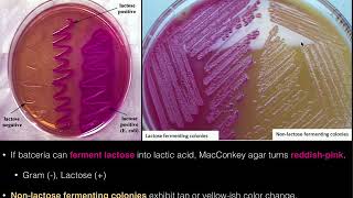 MacConkey Agar [upl. by Fae]