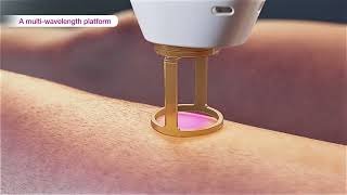 Laser hair removal  GentleMax Pro Plus 3D medical device animation [upl. by Karlotte]