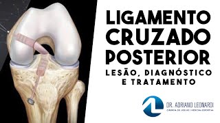 LIGAMENTO CRUZADO POSTERIOR Lesão diagnóstico e tratamento [upl. by Ermine424]