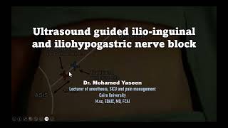 Ultrasound guided ilioinguinal and iliohypogastric nerve block [upl. by Danell22]