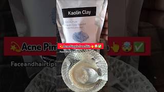 Acne diy face mask👆kaolin clay pimpleproblemshortkoreanskincareglassskinshortsyoutubeshorts [upl. by Haugen]