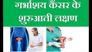 Uterus cancer symptoms in hindi [upl. by Amsirak]