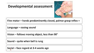 Developmental Assessment in Newborn  Pediatrics [upl. by Reham]