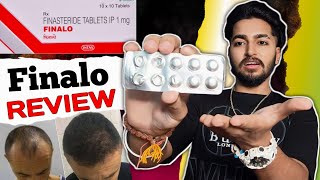 Finalo Finasteride Tablet Review  Finasteride Tablet 1mg  Sahil Nagpal [upl. by Elston159]