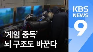 앵커의 눈 ‘게임 중독’ 뇌 구조도 바꾼다…조기 치료 중요  KBS뉴스News [upl. by Hochman]