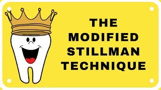 Modified Stillman Technique [upl. by Haem]