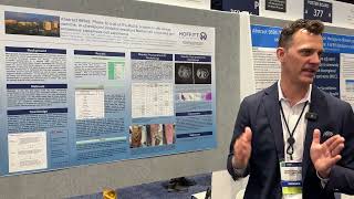 Andrew Brohl at ASCO 2024  Abstract 9592 [upl. by Drahsir651]