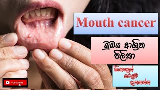 Mouth cancer මුඛ පිලිකා  how it happens causes symptoms treatment how to prevent [upl. by Leahkim729]