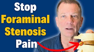 7 Steps to Beat Foraminal Stenosis Without Surgery amp Relieve Nerve Pain  Dr John Zielonka [upl. by Niboc]