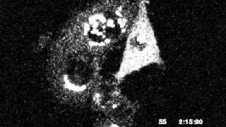 Golgi Proteins in Mitosis [upl. by Aicatan]