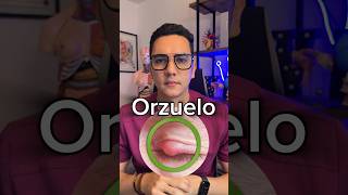 Orzuelo en el párpado del ojo parte 1  Dr William Guerrero medicina shorts [upl. by Adnimra]