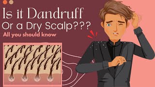 Is It Dandruff Or A Dry Scalp Heres What You Need To Know [upl. by Pantin]