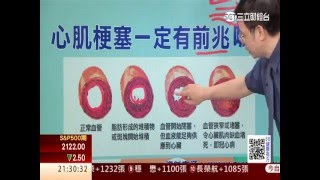 0525 心臟痛會痛到手指頭嗎？第11集2│88健康有方│三立財經台CH88│主持人 張雅芳 [upl. by Odlanra]