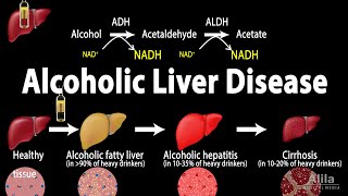 Alcoholic Liver Disease Animation [upl. by Sher]