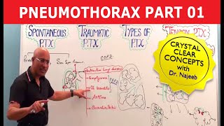 Pneumothorax  Basic Pathology  Part 1🩺 [upl. by Donnell854]