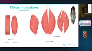 Lesiones Musculares clasificacion  Dra Araceli Cabanillas Segura [upl. by Dowling711]