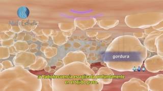 ¿Qué es la Radiofrecuencia [upl. by Cad641]