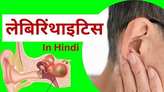 लैबिरिंथाइटिस  कारण लक्षण प्रबंधन  nursing notes in hindi  labyrinthitis in hindi [upl. by Keraj]