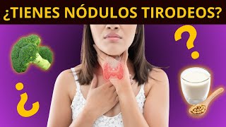 ¿TIENES NÓDULOS TIROIDEOS síntomas diagnóstico y tratamiento [upl. by Arst]