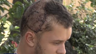 Alligator bites down on Florida mans head [upl. by Alwyn]