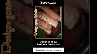 FMS Dental  Best Cosmetic Dental Clinic in Hyderabad  Smile Correction [upl. by Novehs802]