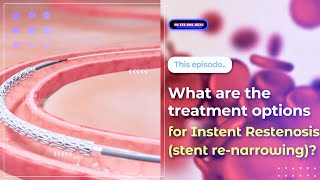 What are the treatment options for Instent Restenosis stent renarrowing [upl. by Nerrad215]