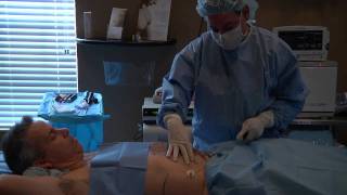 Vaser Liposuction  SmartLipo [upl. by Sharyl]