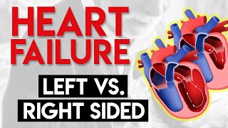 Left vs Right Heart Failure  Heart Failure Part 3 [upl. by Ketty]