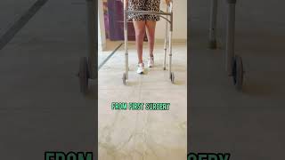 Best Way To Increase Height  Female Patient Increased 8 cm By Height Surgery heightincrease [upl. by Uamak601]