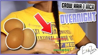 OVERNIGHT HAIR GROWTH  1 INCH  12 hours  EfikZara Growth Hacks [upl. by Gascony813]