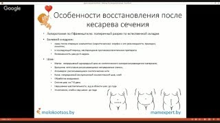 Особенности восстановления после кесарева сечения [upl. by Aitercal]