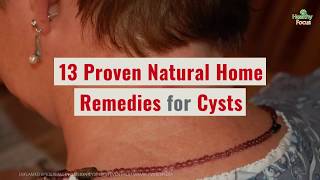 13 Proven Natural Home Remedies for Cyst [upl. by Benedikta]