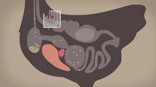 Lyme and Mycotoxins [upl. by Hulda]