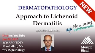 Dermatopathology Approach to Lichenoid Dermatitis  w Dr Singh [upl. by Orola542]