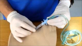 Needle Cricothyroidotomy [upl. by Bean]