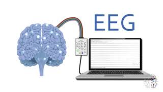 QEEG Brain Scans Explained [upl. by Noivax]