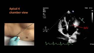 Standard views for a basic echocardiogram [upl. by Schaffer]