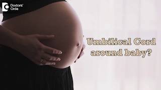 What causes the umbilical cord to wrap around baby  Dr Sapna Lulla [upl. by Etac]