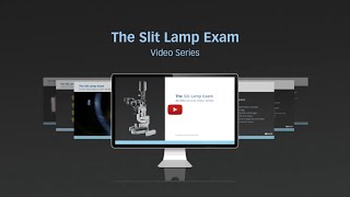 The Slit Lamp Exam  An Educational Video Series [upl. by Ellicott]