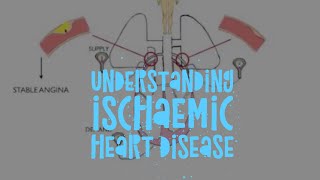 The pathophysiology of ischaemic heart disease [upl. by Rodrique]